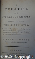 'A treatise on struma or scrofula commonly called the King's Evil'