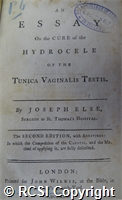 'An essay on the cure of the hydrocele of the tunica vaginalis testis'
