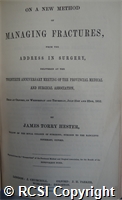 'On a new method of managing fractures, from the address in surgery, delivered at the 20th anniversary meeting of the Provincial Medical and Surgical Association'