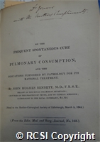 'On the frequent spontaneous cure of pulmonary consumption, and the indications furnished by pathology for its rational treatment'