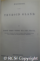 'Excision of the thyroid gland'