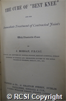 'The cure of 'bent knee' and the immediate treatment of contracted joints'