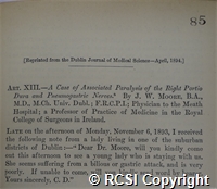 'A case of associated paralysis of the right portio dura and pneumagastric nerves'