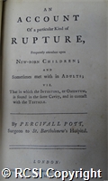 'An account of a particular kind of rupture, frequently attendant upon new-born children; and sometimes met with in adults viz; that in which the intestine, or omentum, is found in the same cavity, and in contact with the testicle'