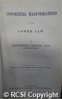 'Congenital malformations of the lower jaw'