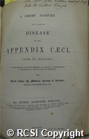 'A short account of a case of disease of the appendix caeci, cured by operations'
