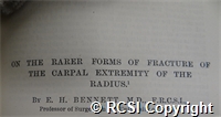 'On the rarer forms of fracture of the carpel extremity of the radius'