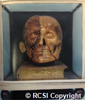 A head - exhibiting the muscles, blood vessels, nerves etc.