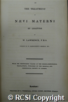 'On the treatment of naevi materni by ligature'