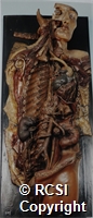 Entire sympathetic nervous system