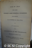 'Case of a man who passed fourteen large intestinal concretions; with remarks'