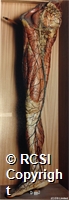 Lymphatics of the right lower extremity