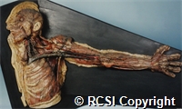 Lymphatics of the head, neck and left superior extremity